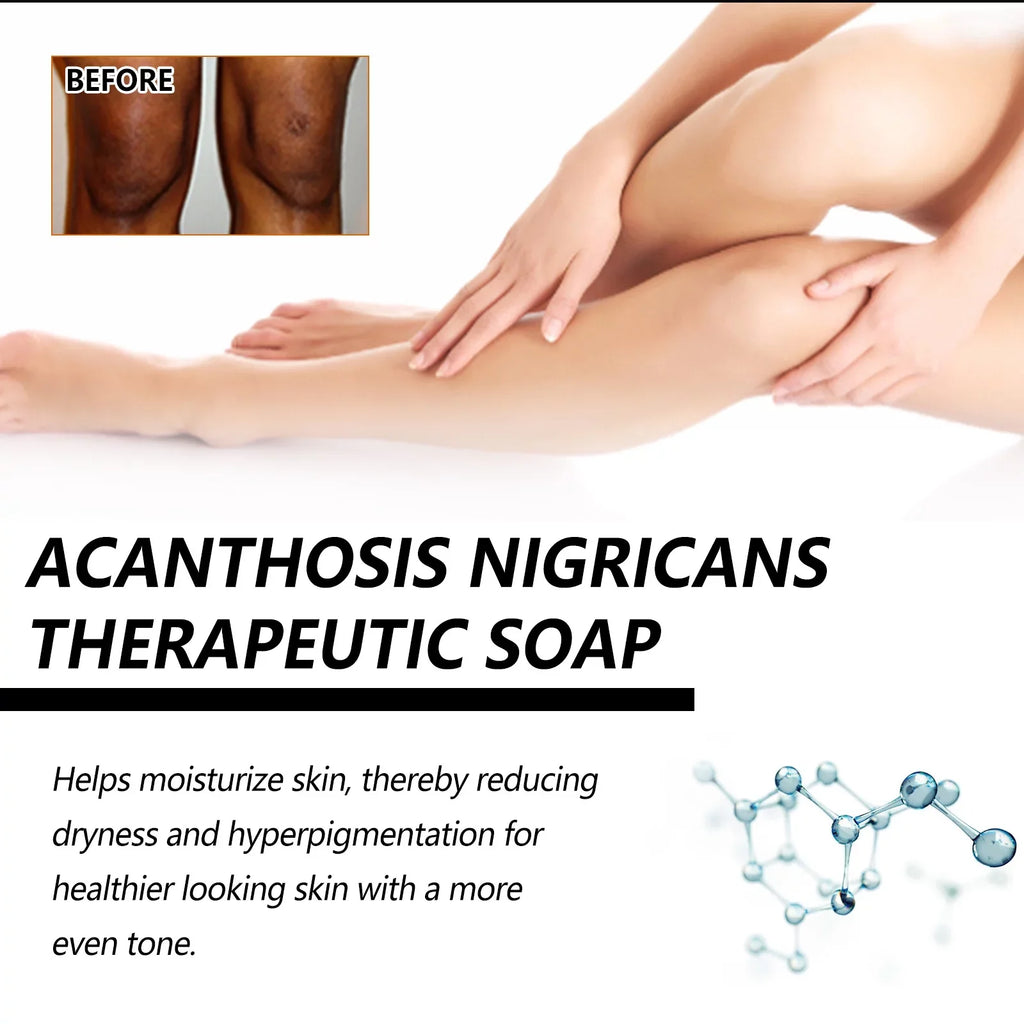 5pcs Underarm Brightening Soap Deep Cleansing Repair Dull Skin Dark Echinacea Moisturizing Brightening Beauty Soap