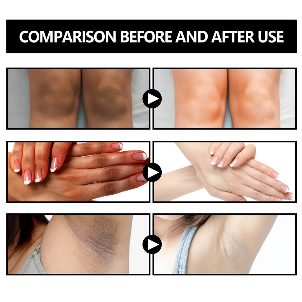 5pcs Underarm Brightening Soap Deep Cleansing Repair Dull Skin Dark Echinacea Moisturizing Brightening Beauty Soap