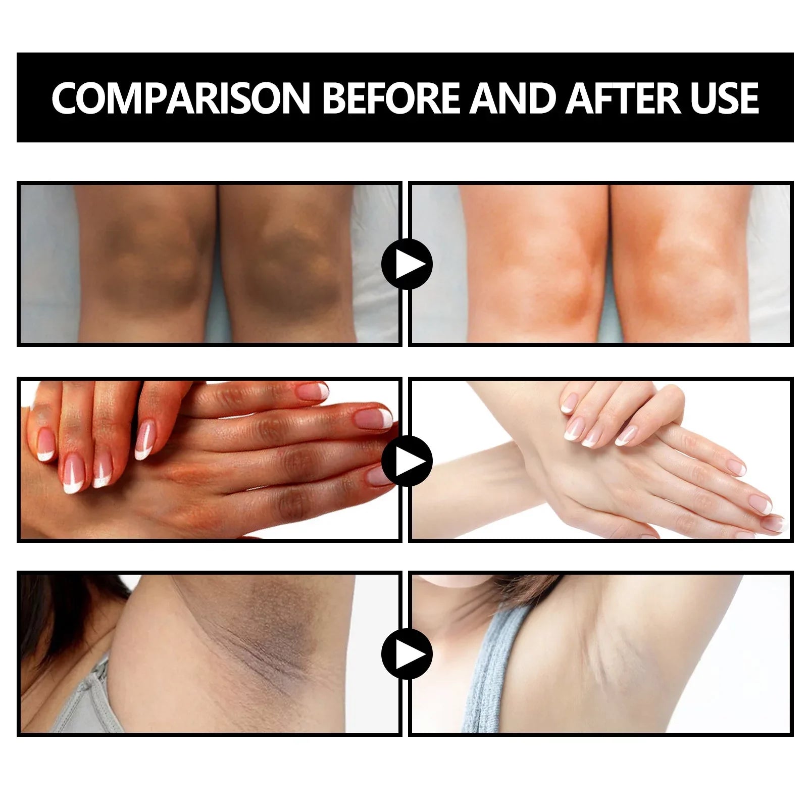 5pcs Underarm Brightening Soap Deep Cleansing Repair Dull Skin Dark Echinacea Moisturizing Brightening Beauty Soap