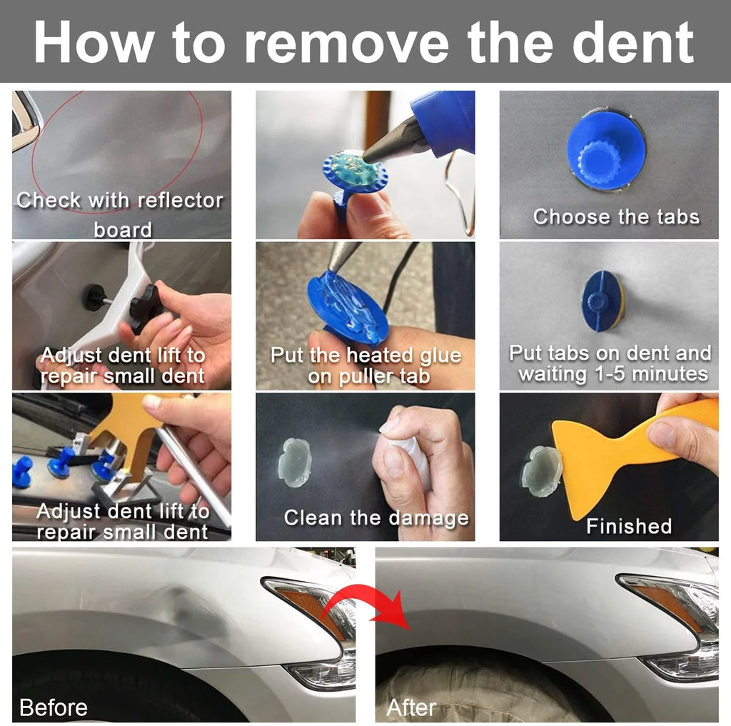 Removal kit, Auto Paintless Dent Repair Kits - Golden Car Dent Puller with Bridge Dent Puller