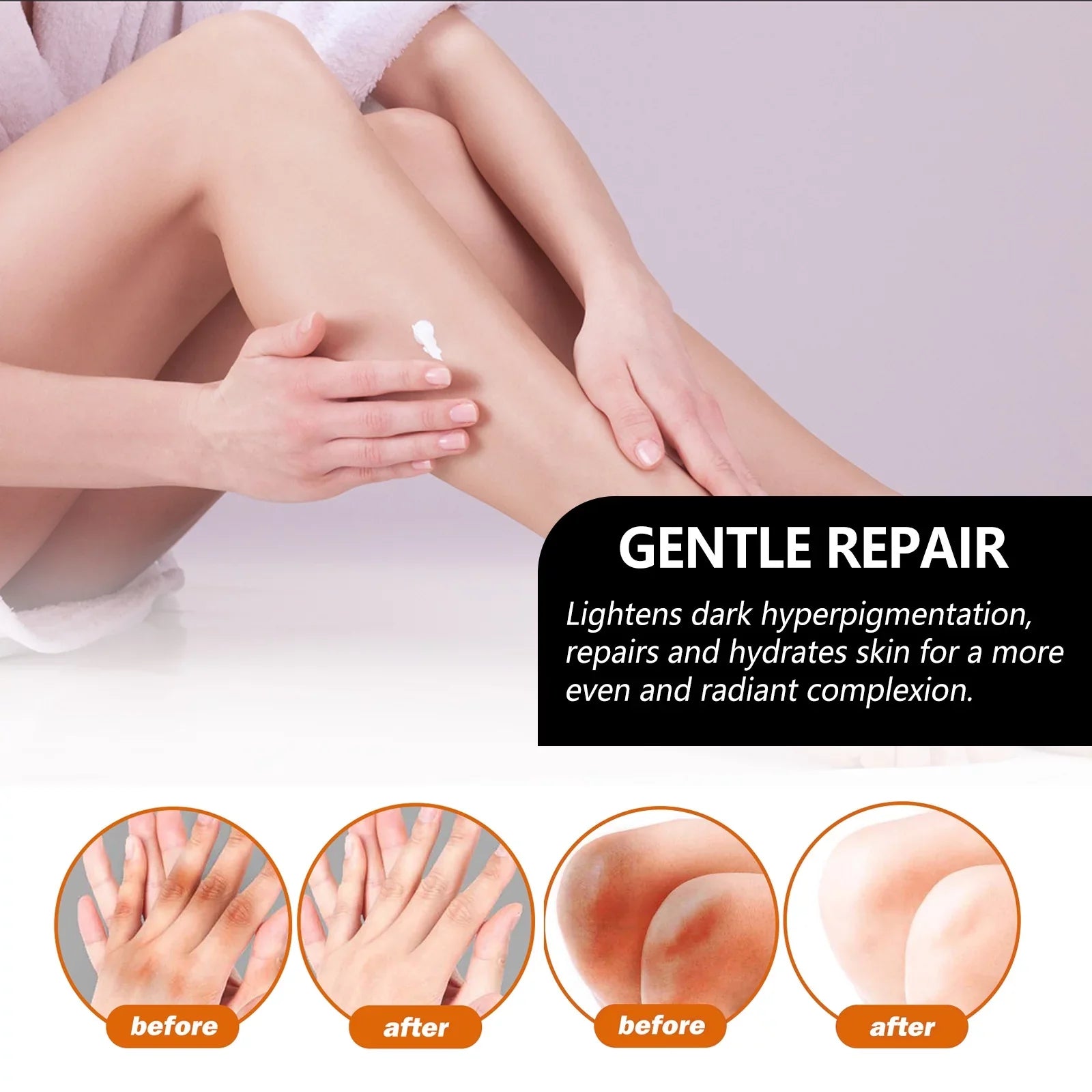 5pcs Underarm Brightening Soap Deep Cleansing Repair Dull Skin Dark Echinacea Moisturizing Brightening Beauty Soap