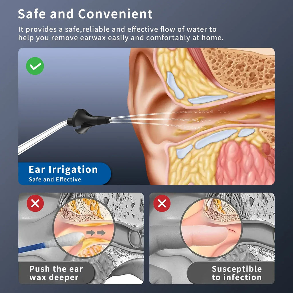 Ear Cleaner Portable Rechargeable Electric Ear Cleaner Ear Cleaner Ear Washer