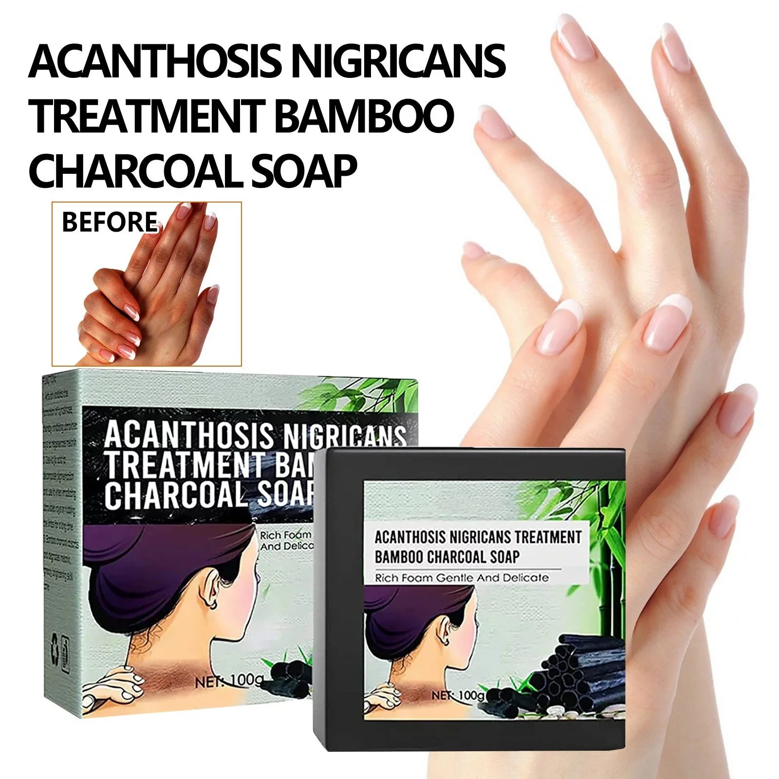5pcs Underarm Brightening Soap Deep Cleansing Repair Dull Skin Dark Echinacea Moisturizing Brightening Beauty Soap